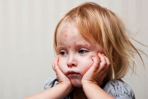 «Dass Kinder nicht gegen Masern geimpft sind, ist oft ein Versehen»