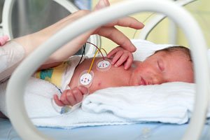 Herzfehler beim Baby: Moderne Medizin lässt Überlebenschancen steigen