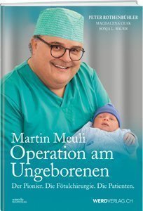 Buchcover «Martin Meuli: Operation am Ungeborenen»