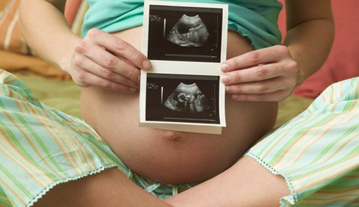 Der erste Ultraschall in der Schwangerschaft ist für viele ein unvergesslicher Moment.