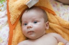 Schuppen beim Baby: Tipps gegen Milchschorf und Kopfgneis