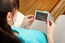 Nabelschnur: So versorgt die schwangere Mutter ihr wachsendes Kind