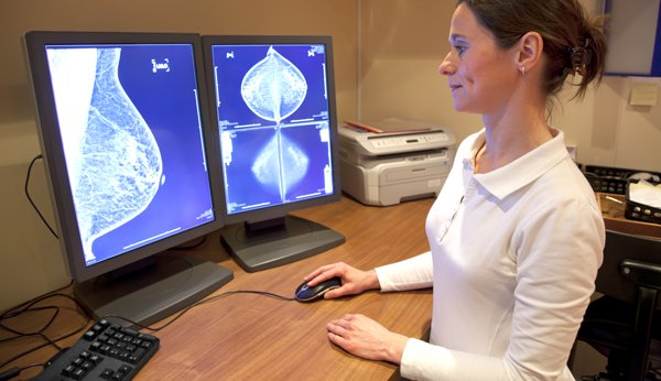 Zur Früherkennung von Brutskrebs kann eine Mammographie sinnmvoll sein.