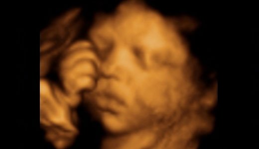 Das Gesicht des Babys ist beim 3D Ultraschall gut zu erkennen.