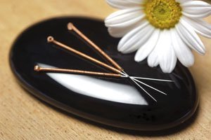 Akupunktur in der Schwangerschaft: Nutzen, Kosten, Nebenwirkungen