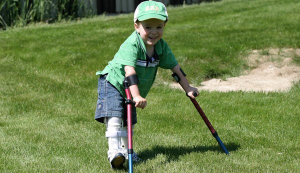 As crianças com espinha bífida têm frequentemente problemas em andar.