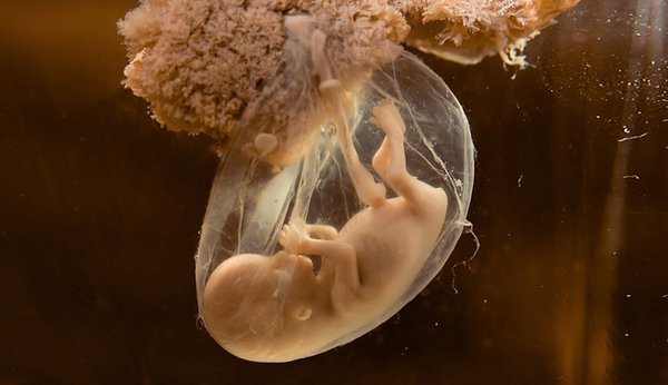 Fruchtblase und Fruchtwasser – ein kleines, sicheres Universum für Ihr Baby