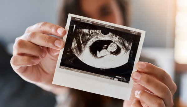 À la 14e semaine de grossesse, le sexe de l'enfant peut souvent être déterminé.