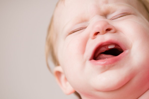 Kleines Kind mit verzerrtem Gesicht und einem Schneidezahn, ein zweiter Zahn ist kurz vor dem Durchbruch