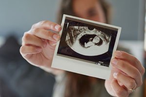 Ist ausfluss was schwanger Vaginaler Ausfluss