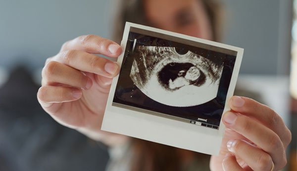 Entwicklung des Fötus: Eine werdende Mutter hält ein Ultraschallbild in die Kamera.